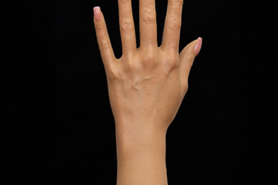 Joint, Finger, and Toe Handling: The Slow-Movement Rule